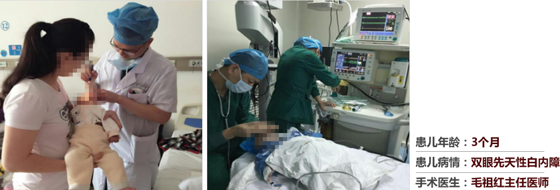 患兒年齡：3個(gè)月，患兒病情：雙眼先天性白內(nèi)障，手術(shù)醫(yī)生：毛祖紅主任醫(yī)師