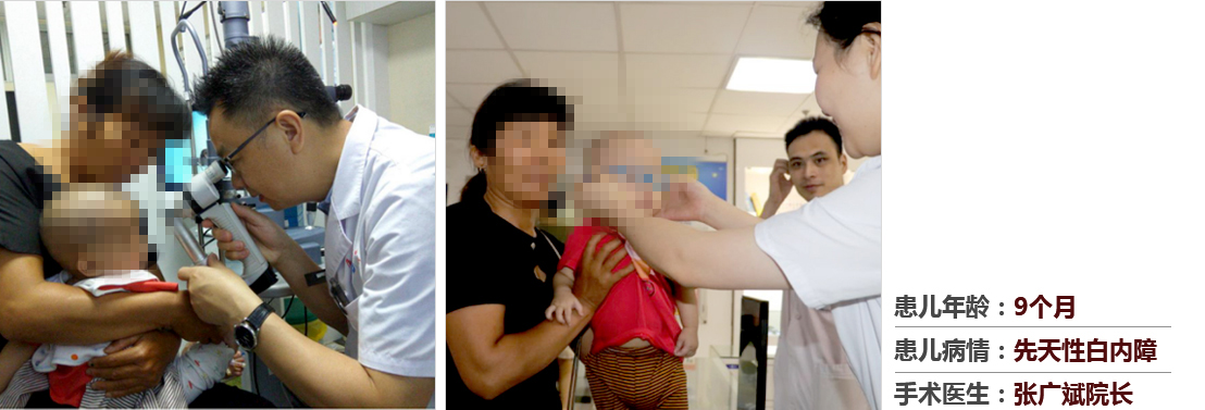 患兒年齡：9個(gè)月，患兒病情：先天性白內(nèi)障，手術(shù)醫(yī)生：張廣斌院長(zhǎng)
