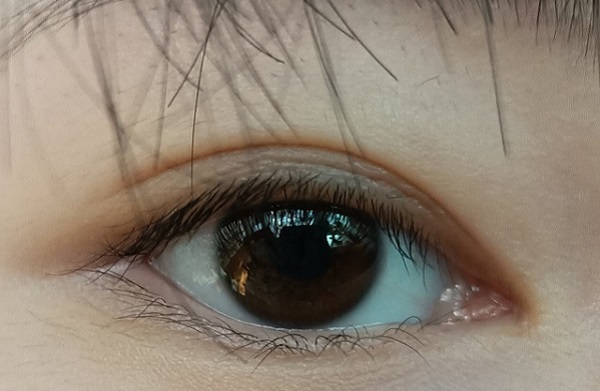 倒睫怎么辦？